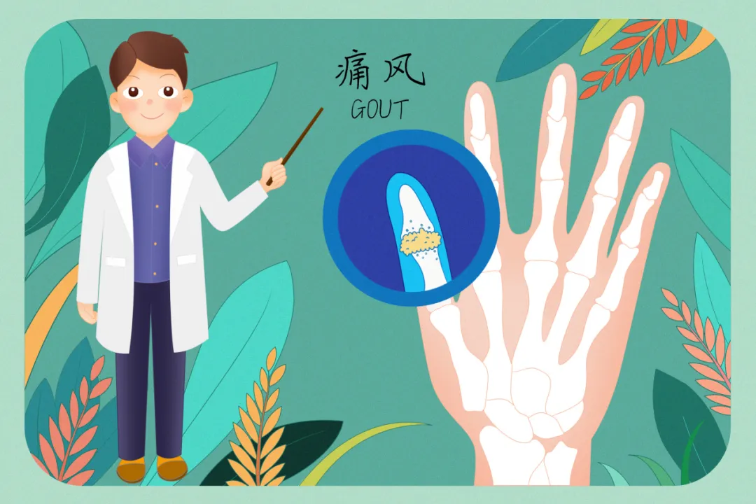 尿酸高但关节不痛，就不用管吗？| 科普时间